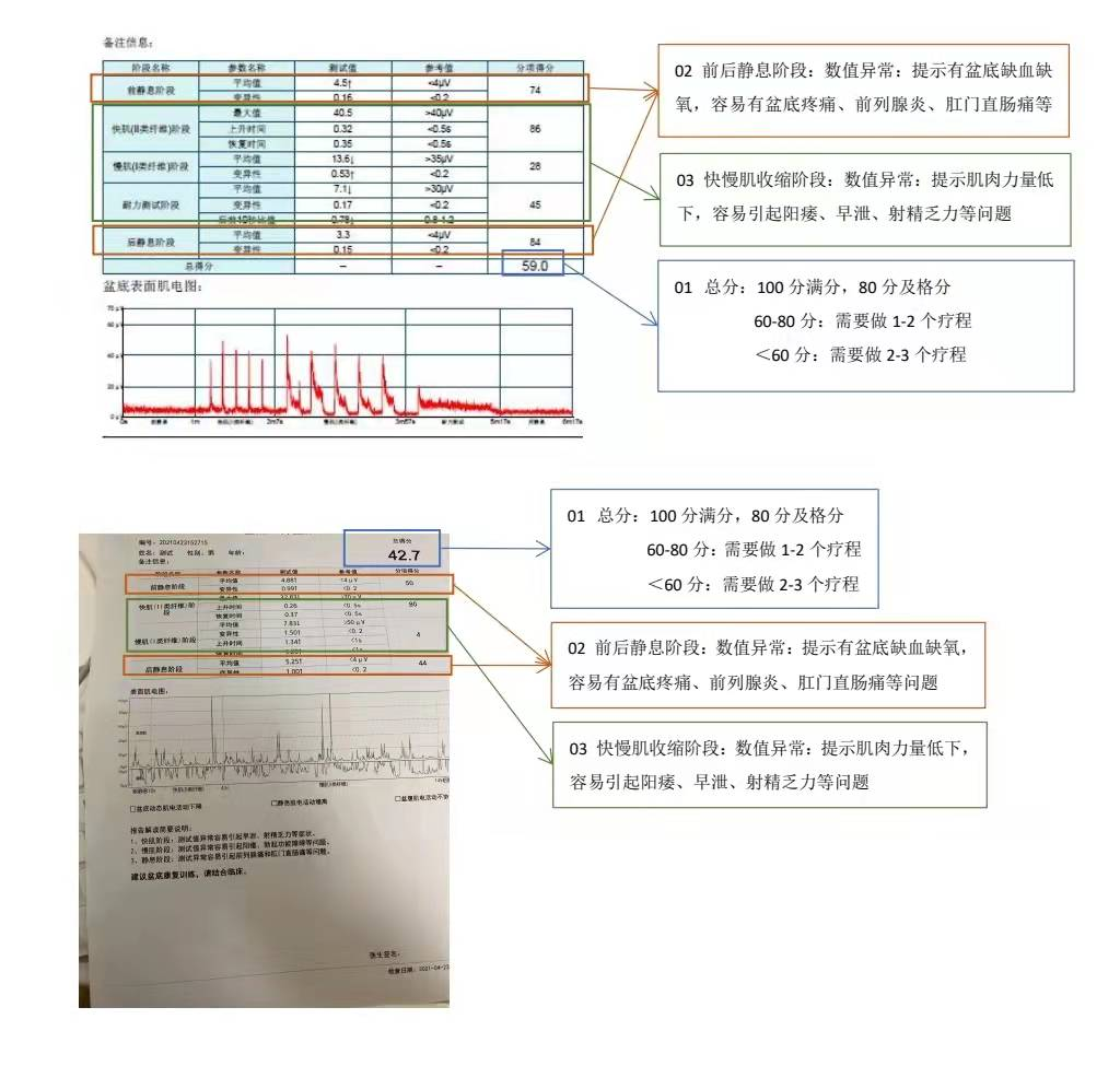 亭亭玉立